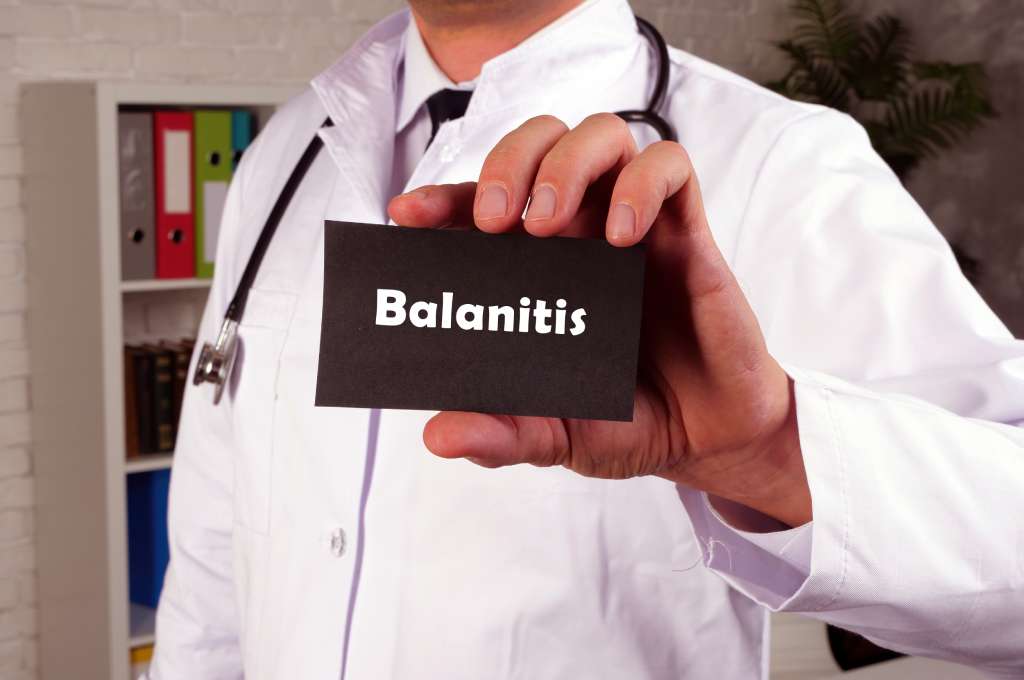 Síntomas de la balanitis